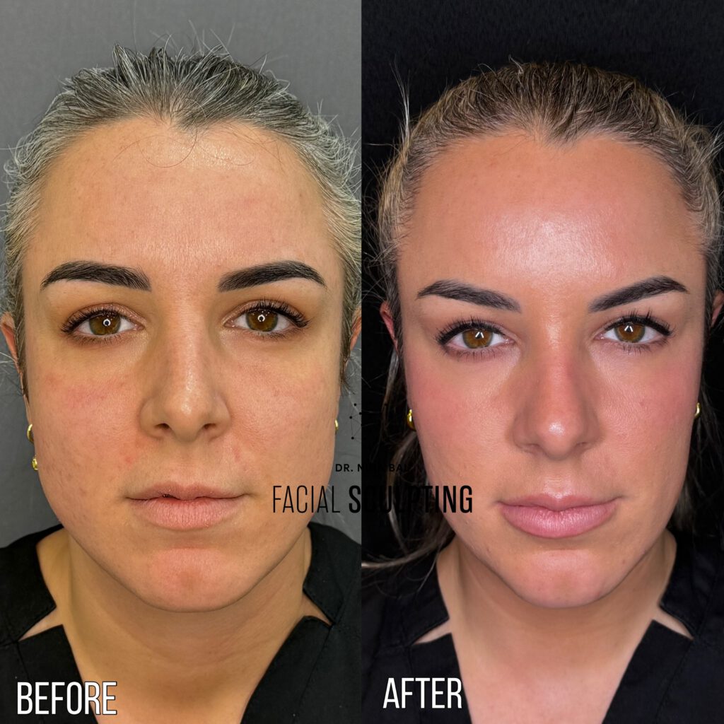 Face Shape Sculpting's Review Image