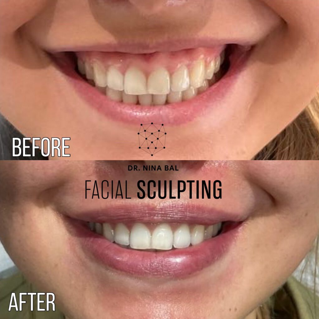 Lip Enhancement's Review Image