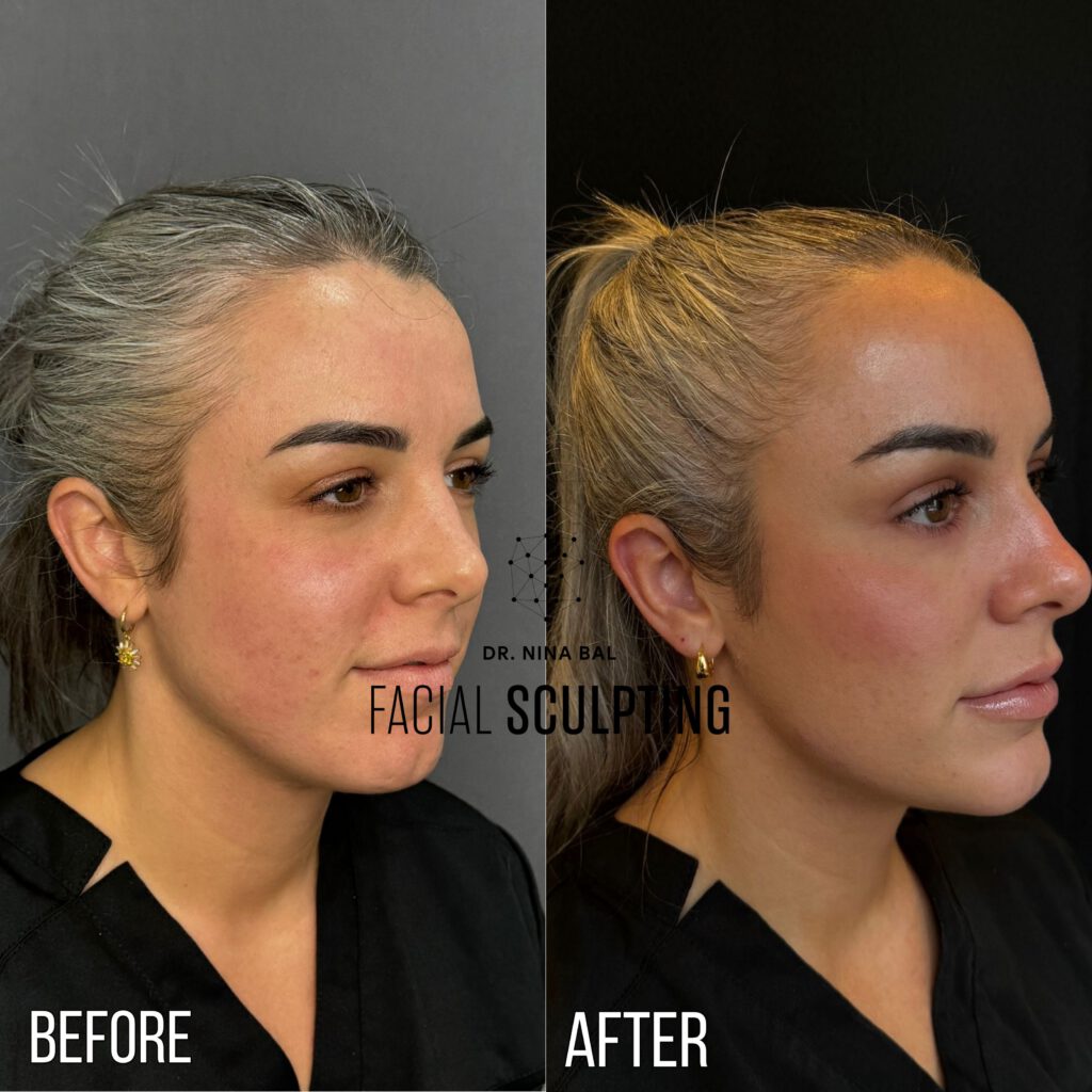 Side Profile Sculpting's Review Image
