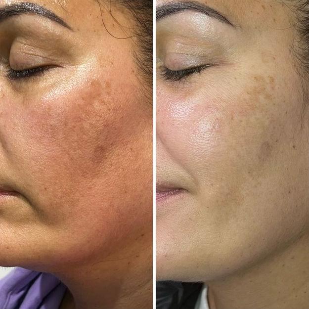 Dermalux LED's Review Image