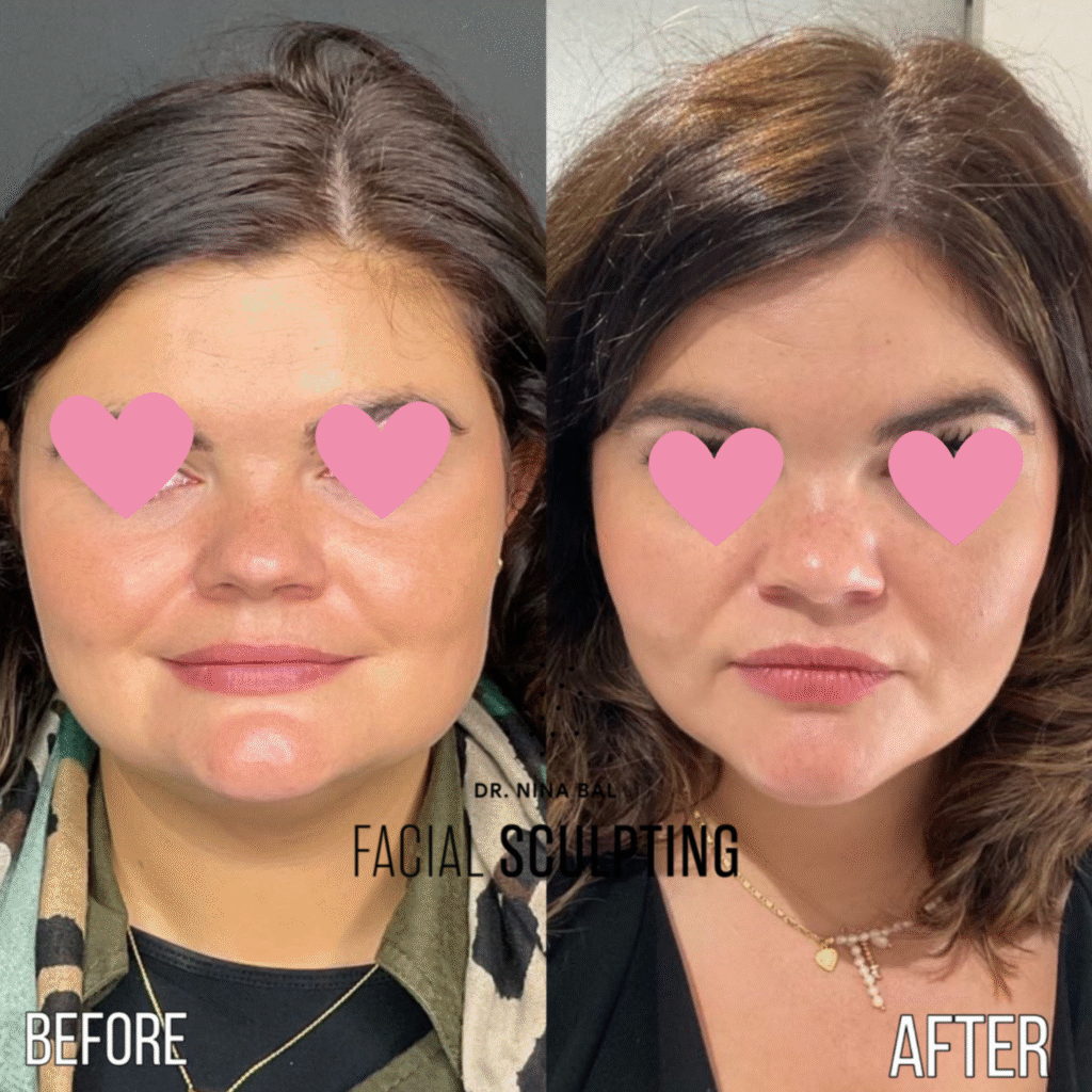 Jawline Slimming / Bruxism's Review Image