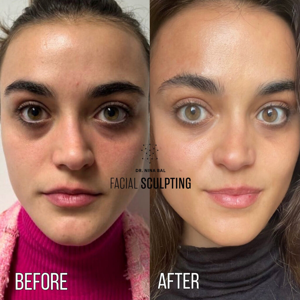 Light Eyes Treatment's Review Image